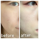 Review serum Melano CC